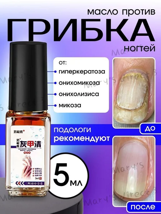 Масло для ногтей 5мл, 5 мл, фото 3