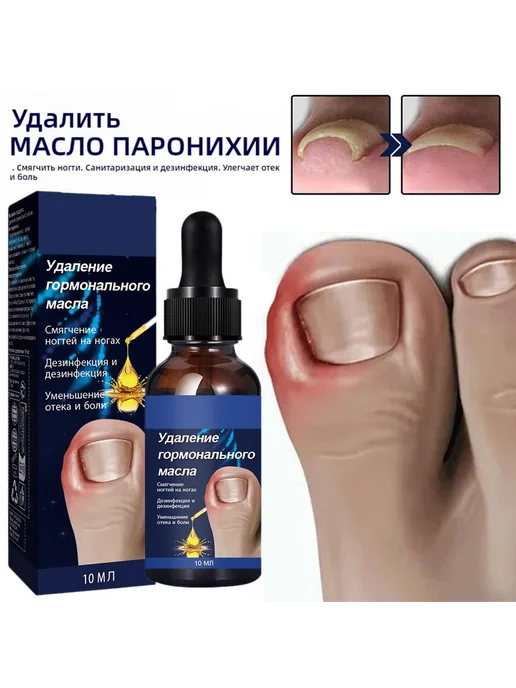 Масло для ногтей от вросших ногтей 20г 9.8мл, 20 г, 9,8 мл