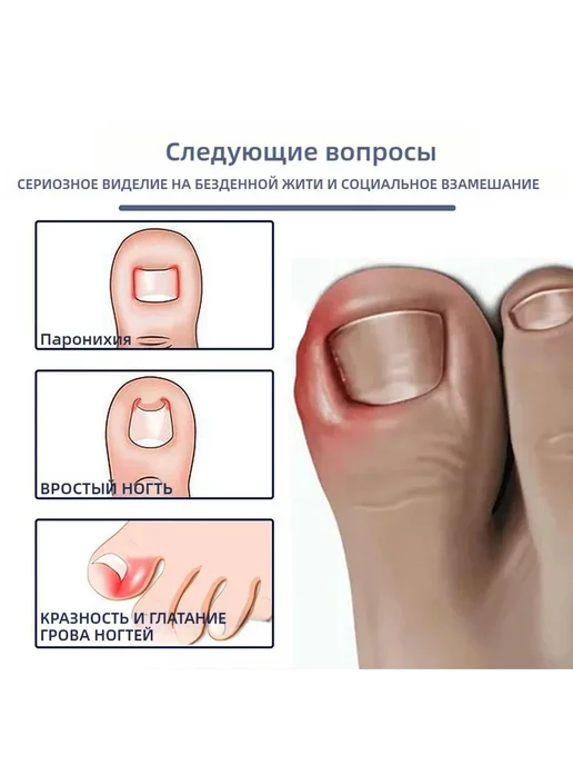 Масло для ногтей от вросших ногтей 20г 9.8мл, 20 г, 9,8 мл, фото 2