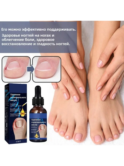 Масло для ногтей от вросших ногтей 20г 9.8мл, 20 г, 9,8 мл, фото 3