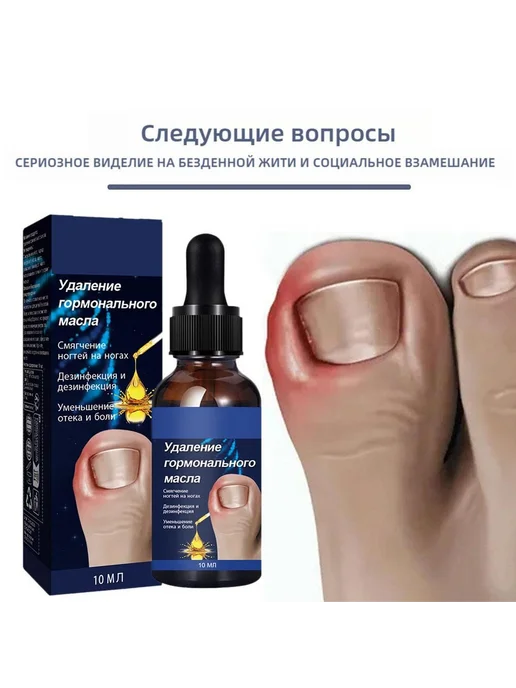 Масло для ногтей от вросших ногтей 20г 9.8мл, 20 г, 9,8 мл, фото 4