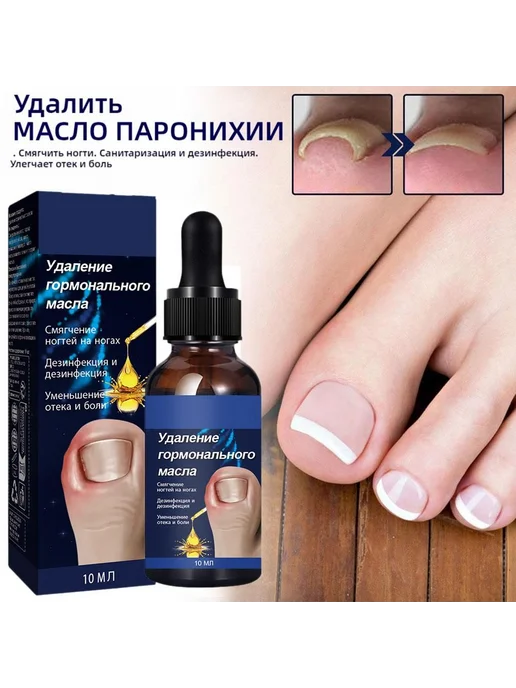 Масло для ногтей от вросших ногтей 20г 9.8мл, 20 г, 9,8 мл, фото 5