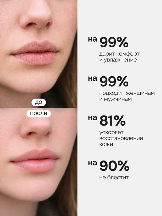 NRAV Бальзам для губ увлажняющий, белый, фото 2