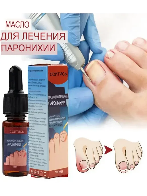 TAIS Масло от грибка ногтей средство от вросших ногтей паронохии, вариант, фото 2