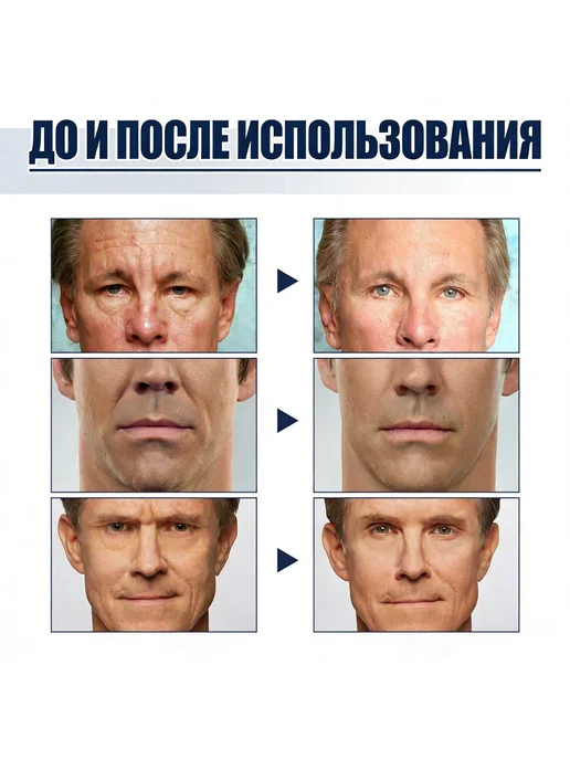 Набор масок для лица мужской от морщин с ниацинамидом 15*2шт, 15x2, фото 8
