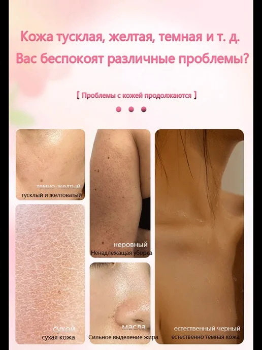 Ниацинамидное отбеливающее мыло для тела и лица, вариант, фото 4