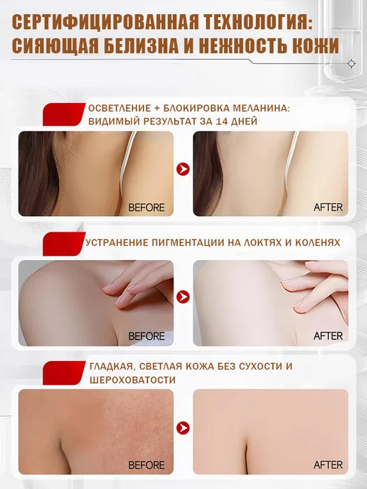 Ниацинамидное отбеливающее мыло для тела и лица, вариант, фото 5