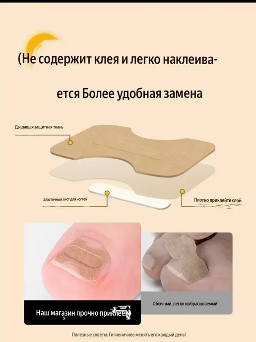 Канида Корректор вросшего ногтя в домашних условиях 50шт, 50 шт, фото 3