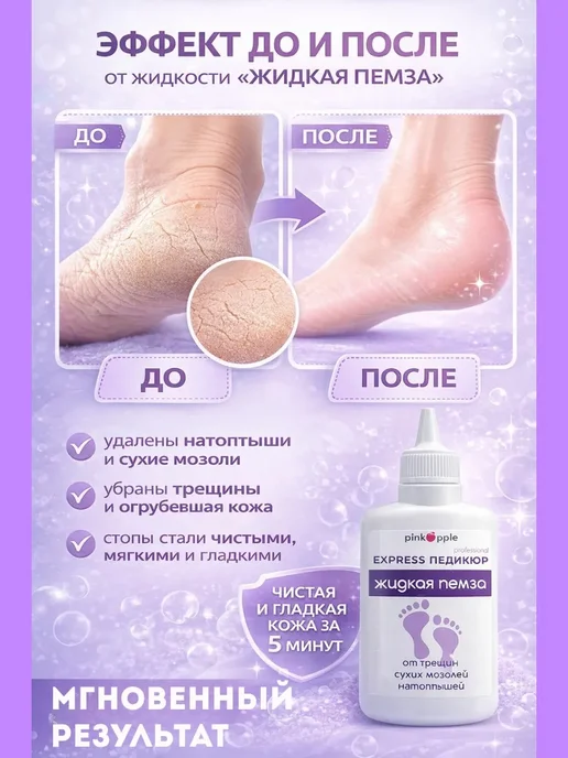 NK96 Жидкая пемза для ног уход за стопами, вариант, фото 2