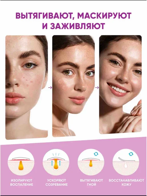 Патчи от прыщей, наклейки на прыщ, вариант, фото 2