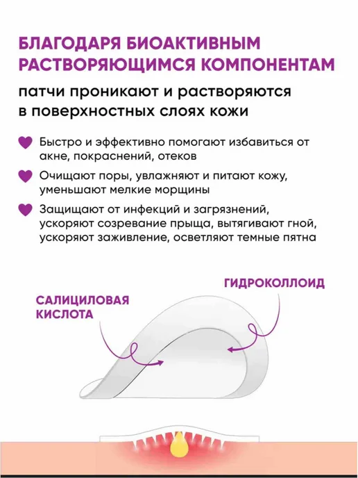 Патчи от прыщей, наклейки на прыщ, вариант, фото 3