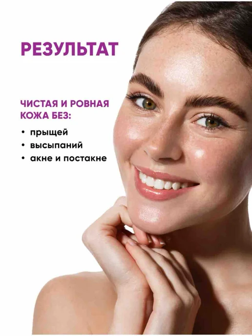 Патчи от прыщей, наклейки на прыщ, вариант, фото 7