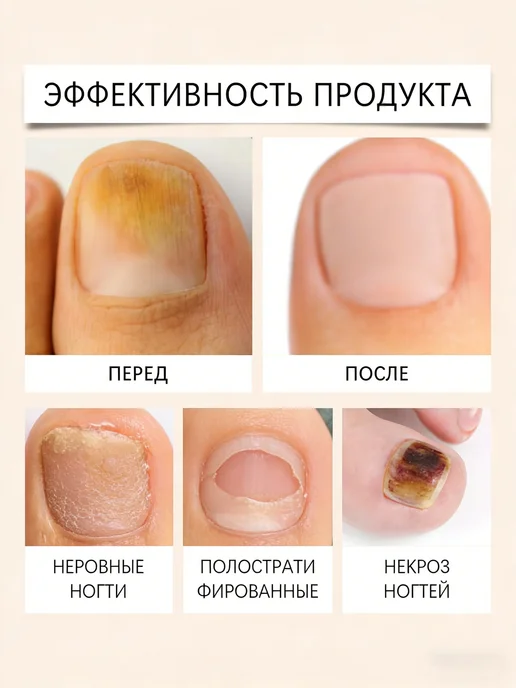 уход за ногтями, вариант, фото 6