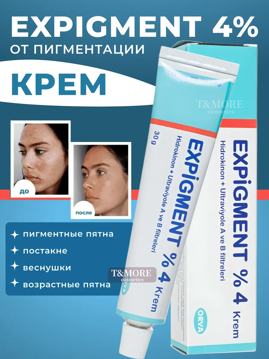 Крем для лица отбеливающий пигментацию експигмент