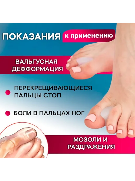 Силиконовые ортопедические разделители для пальцев ног, 4 шт, 4 шт, фото 3