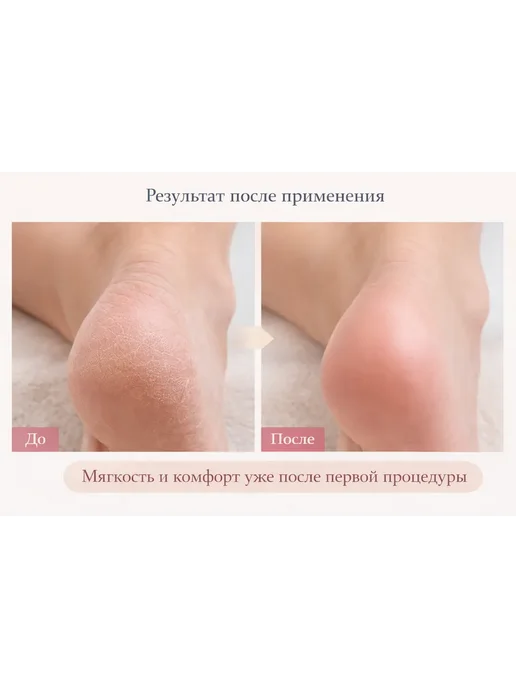 rai3 Пемза для ног, вариант, фото 3