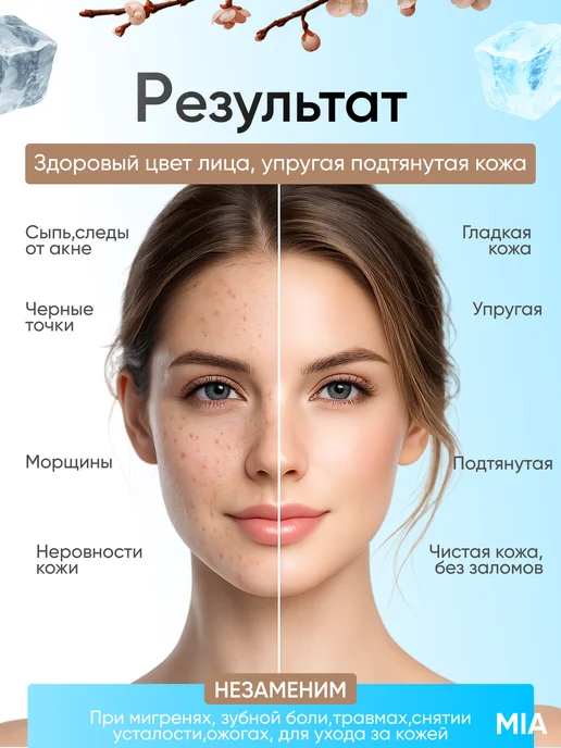 Ледяной роликовый массажер для лица и тела, голубой, фото 6