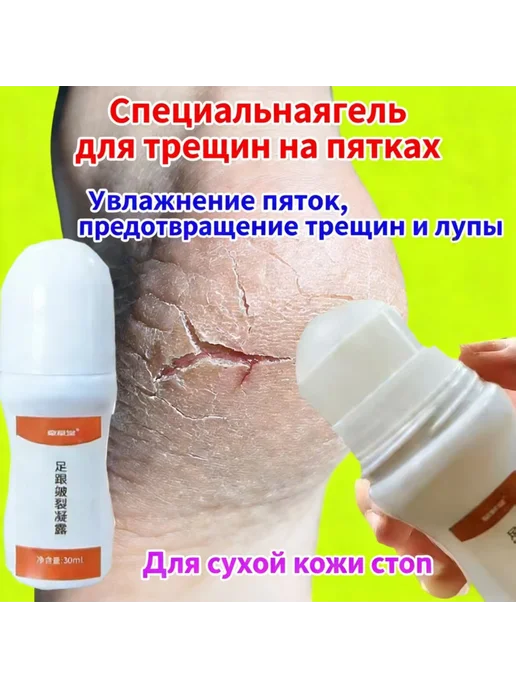 синтенсивным увлажнением от трещин и шелушения ель для пяток, вариант, фото 2